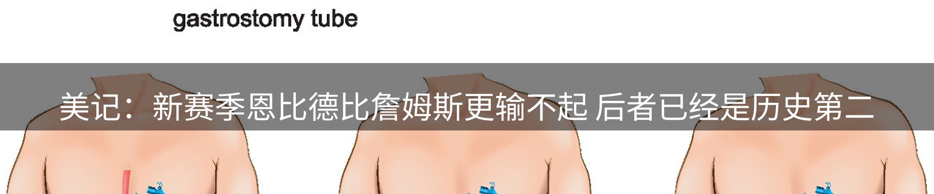 赛事资讯